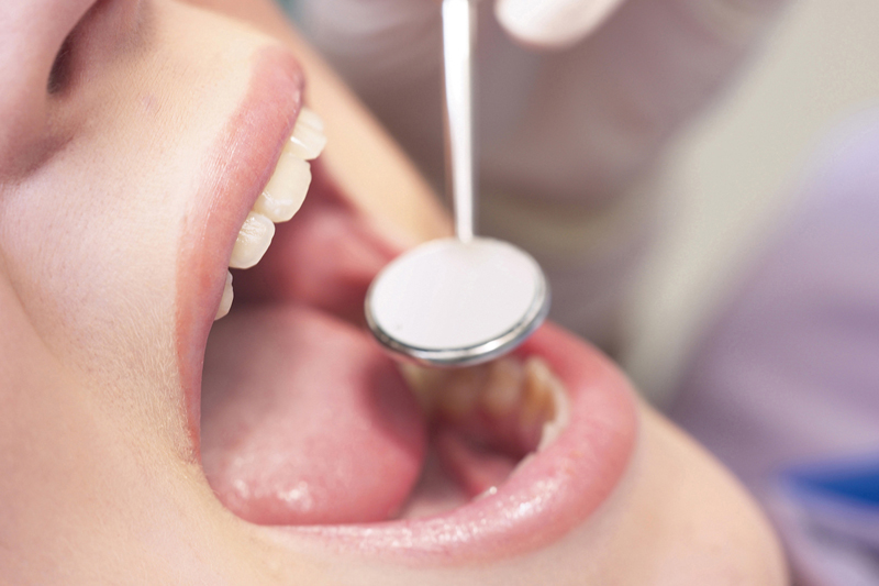 歯周病予防について