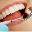 予防歯科について
